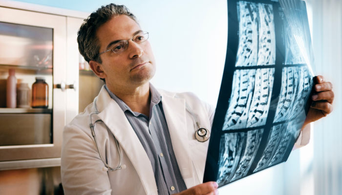 Misconceptions of Spinal Surgery