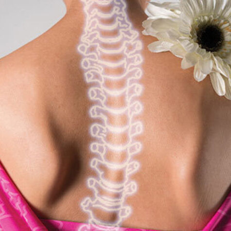 scoliosis